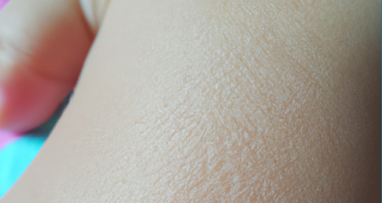 أفضل طرق العناية بالبشرة الجافة عند الأطفال: حماية، حب، وحنان في كل قطرة ترطيب 🌼