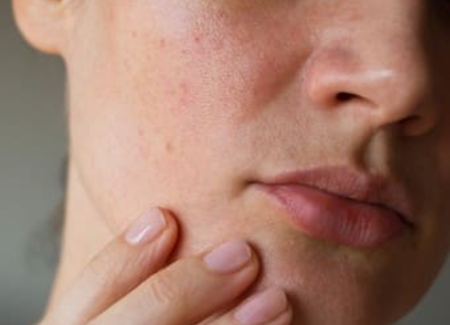 أهم طرق العناية بالبشرة الجافة: دليلك للتوهج الطبيعي والنعومة المخملية 🌿