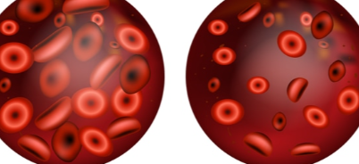 🌹 علاج فقر الدم للحامل: دليلك الذهبي لاستعادة الطاقة وصحة الجنين