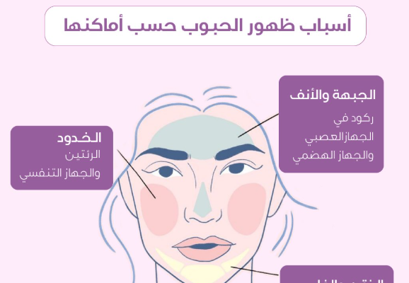 أسباب ظهور الحبوب في الوجه: الحقيقة الكاملة التي لا يخبرك بها أحد!